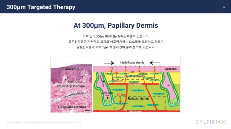 [잠실 연세힐 피부과] 기미 치료의 새로운 패러다임 :  실펌 엑스(Sylfirm X) 관련 이미지 5