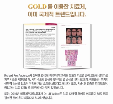 [잠실 연세힐피부과] 골드 PTT : 골드와 레이저 빛을 이용한 여드름 치료의 신기원 관련 이미지 9