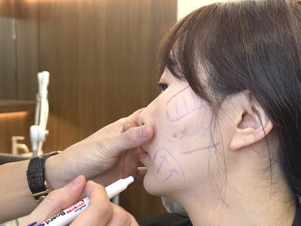 리프팅 하나에도 의사의 생각을 담아야하는 이유. 릴리브의원 관련 이미지 3