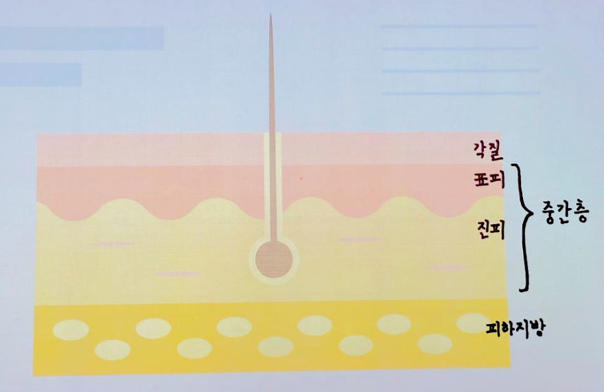 티타늄리프팅 효과 있을까? 3가지 파장 레이저 원리 정리 관련 이미지 3