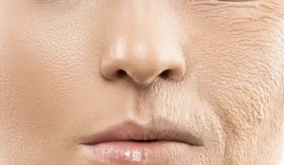 리쥬란 힐러 효과는 높이고 통증은 줄이는 방법 관련 이미지 2