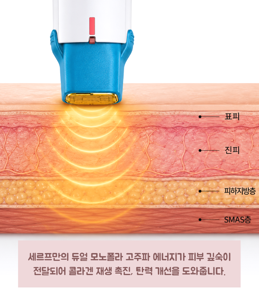 프리미엄 리프팅 세르프 넓어진 모공 피부결이 고민이라면 관련 이미지 4