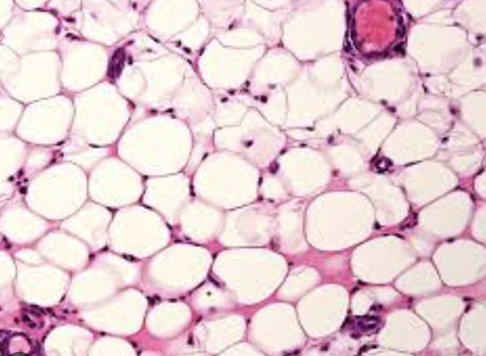 주베룩 볼륨, 필러는 무서우신 분들 관련 이미지 3