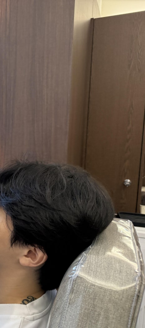 강남 포텐자, 모공 제대로 줄이고 싶다면 3가지 조건 알고 가세요 관련 이미지 9