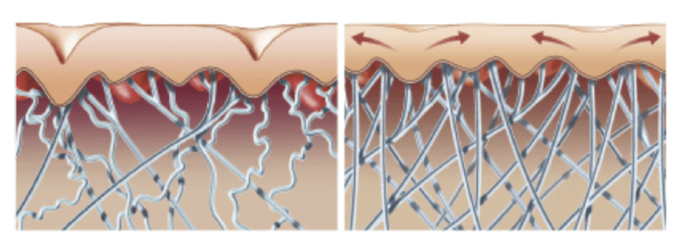 세르프 600샷 300샷 몇 샷을 받아야 할까 관련 이미지 4