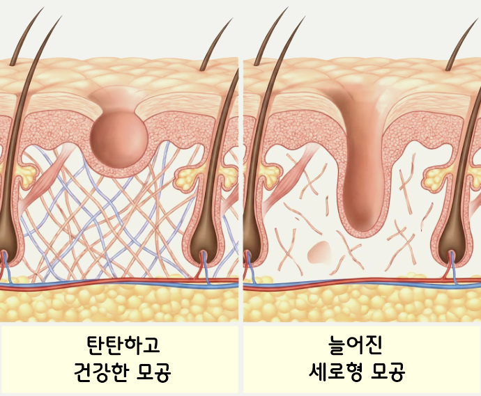리투오 스킨부스터 효과 피부관리해도 효과가 없었다면? 관련 이미지 3