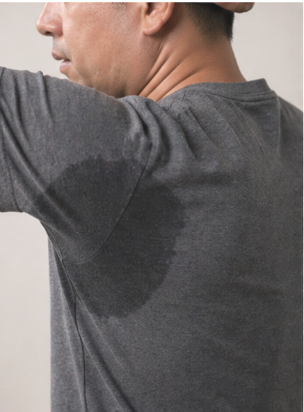 If Sweating Is Uncomfortable, What Are the Criteria for Choosing Hyperhidrosis Botox? image 3