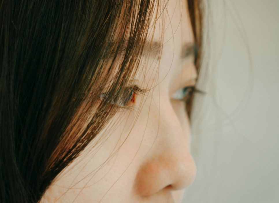 코실리프팅 궁금한질문 하이코 유지기간 부작용 총정리 관련 이미지 1