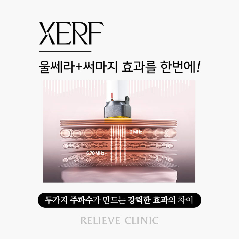 세르프 리프팅 효과와 원리 총정리 써마지와 무엇이 다를까 관련 이미지 3