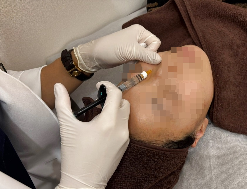 Will the Reutuo Effect Appear Right Away? Actual Timeline of ECM Skin Booster Changes image 6