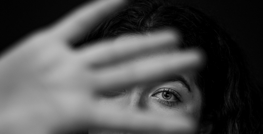 이마 필러 쥬비덤필러 자연스럽게 하려면 몇 cc 필요할까 관련 이미지 1