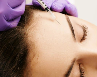 이마필러 왜 조금만 바꿔도 달라질까 필러선택기준 관련 이미지 3