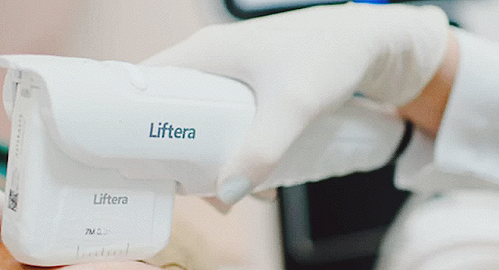 리프테라 펜타입과 라인타입 유지기간은 얼마나 될까? 관련 이미지 5