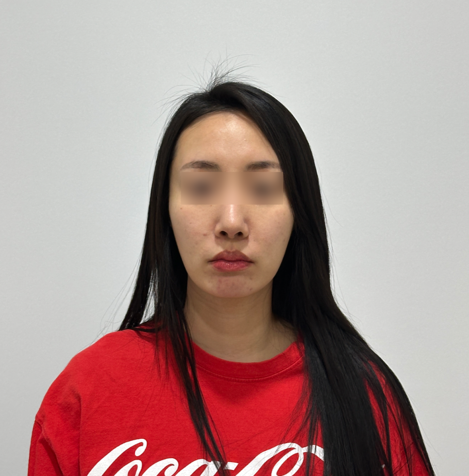 세르프 리프팅 600샷 300샷 뭘 해야할까? 관련 이미지 4