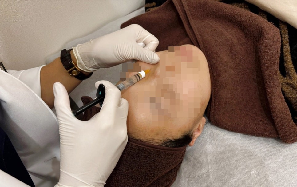 추천하는 콜라겐부스터 쥬베룩볼륨 리투오 레디어스 비교 정리 관련 이미지 8