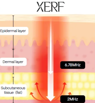 Can You Get Serrf Lifting Now? Explained Based on 300-Shot and 600-Shot Standards image 4