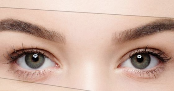 미간보톡스 의사가 알려주는 핵심과 부작용 관련 이미지 6