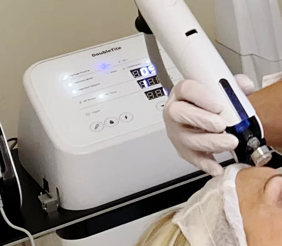 모공 줄이는법 더블타이트 하나로 두가지 효과를 동시에 관련 이미지 4