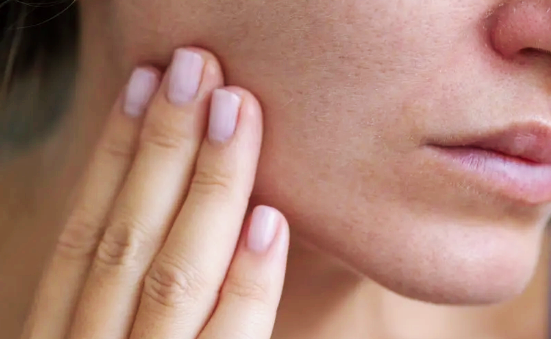 세르프 원리와 리프팅뜻 시술과정까지 한번에 관련 이미지 1