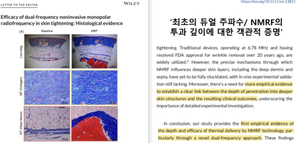 세르프 600샷 300샷 몇 샷을 받아야 할까 관련 이미지 3