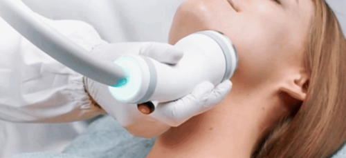 온다리프팅 울쎄라 통증비교 효과는 언제부터 나타날까? 관련 이미지 3