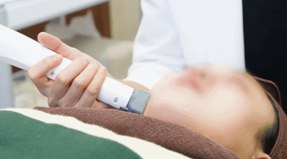 써마지 시술과 울쎄라 효과를 한 번에! 통증까지 잡은 세르프 리프팅 관련 이미지 2