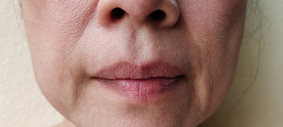 리프테라 후기 주기 효과 볼 수 있는 유형 등 관련 이미지 2