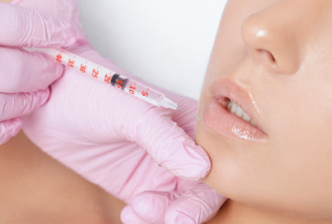 입술필러 1cc 전후 레스틸렌 쥬비덤 비교해서 추천 관련 이미지 5