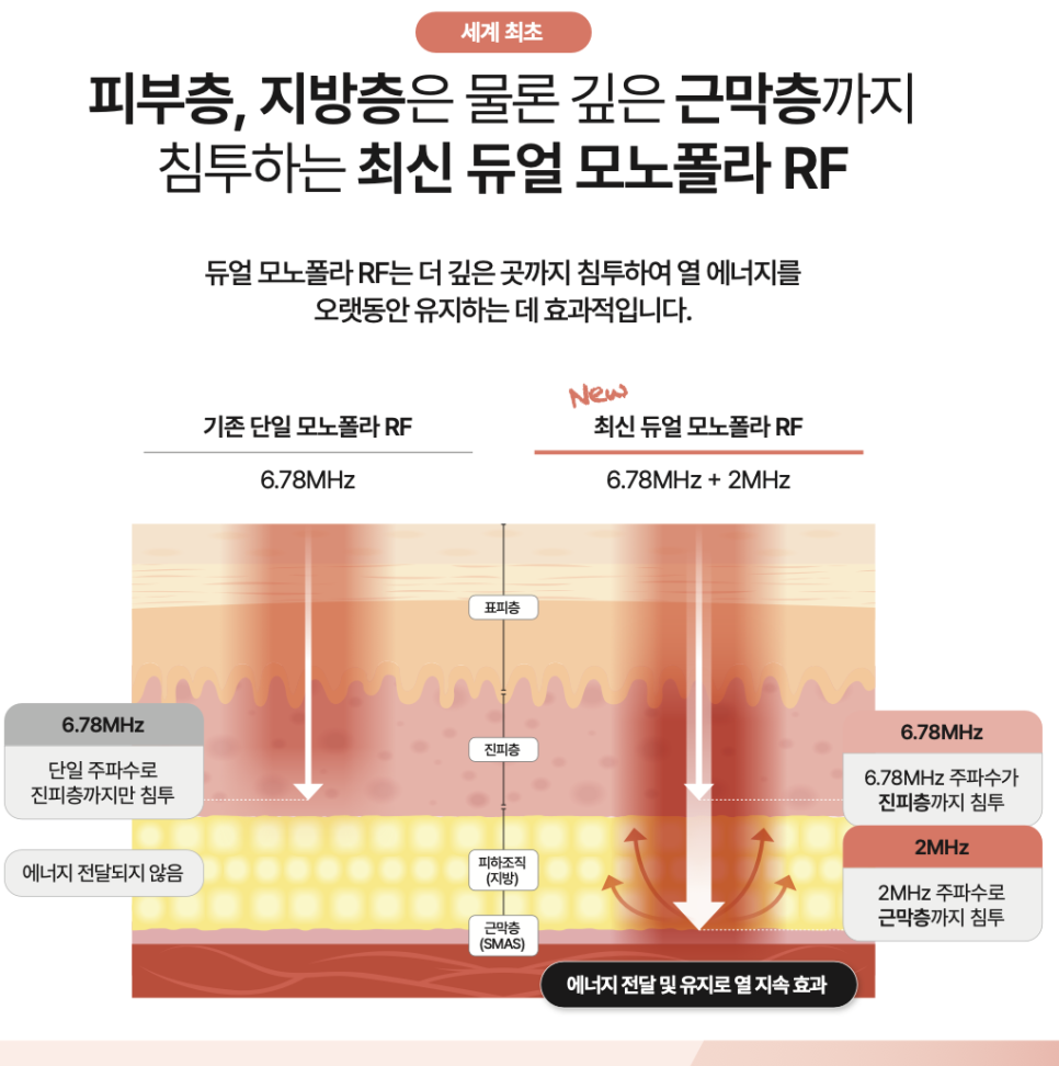 세르프 600샷 300샷 몇 샷을 받아야 할까 관련 이미지 2