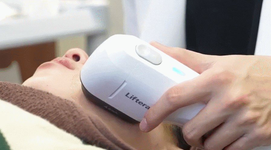 리프테라가격 피부과 선택시 고려사항까지 관련 이미지 1