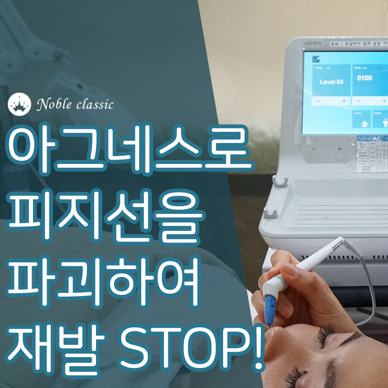 당산피부과잘하는곳 트러블엔 아그네스가 딱! 관련 이미지 6