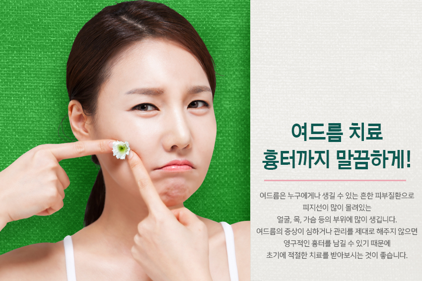 당산동피부과 지겨운 여드름 고민 해결~ 관련 이미지 2