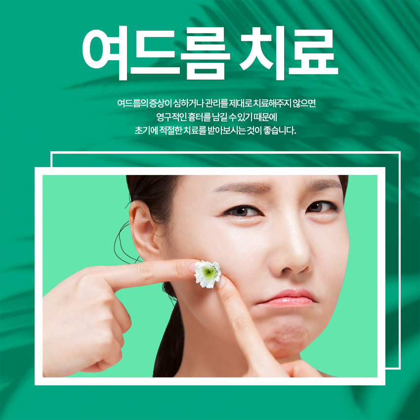 당산역피부과 여드름, 올바르게 치료해요! 관련 이미지 2