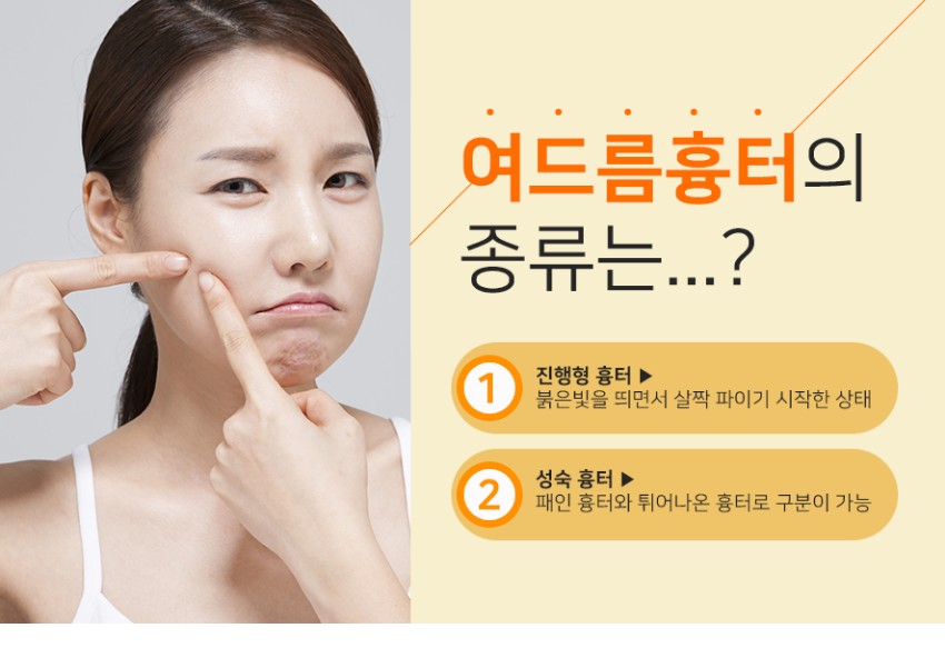 당산피부과 여드름피부 관리가 어려웠다면~ 관련 이미지 3