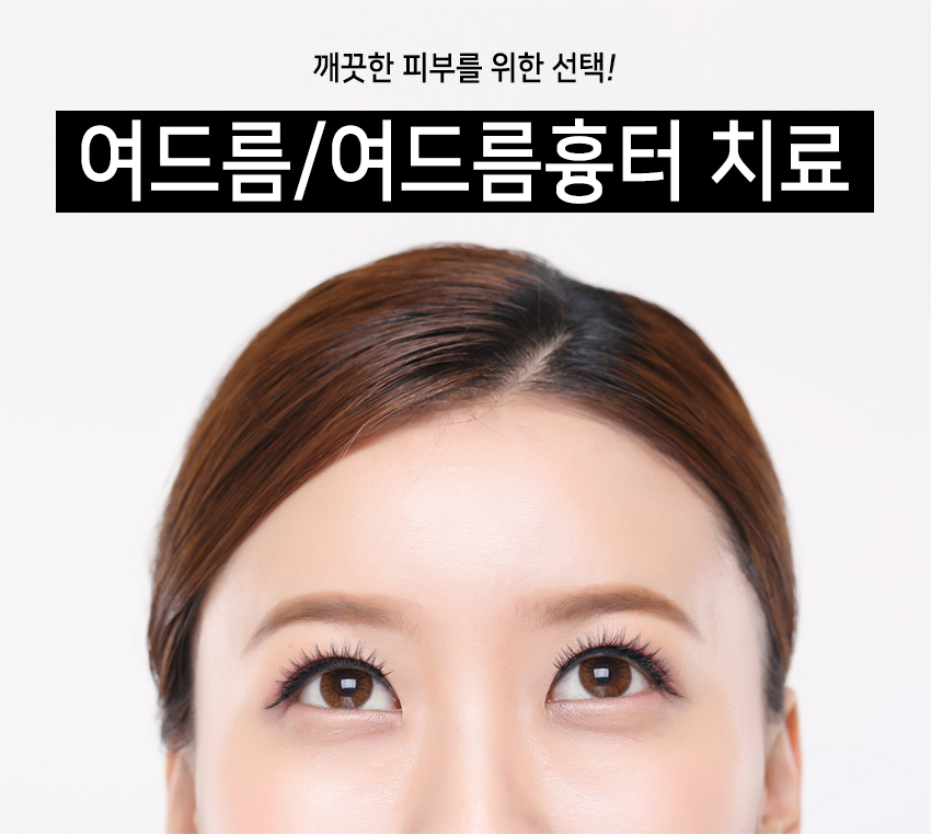 문래동피부과 아프지 않은 여드름치료 관련 이미지 2