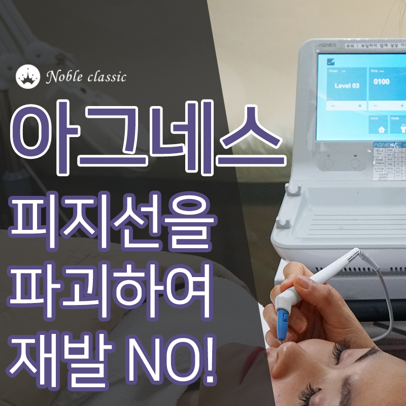 당산여드름피부과 아그네스로 깨끗하게! 관련 이미지 7