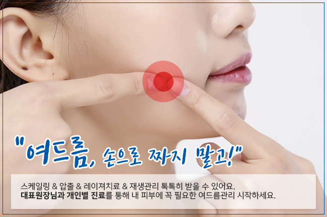당산역피부과 여드름, 올바르게 치료해요! 관련 이미지 7