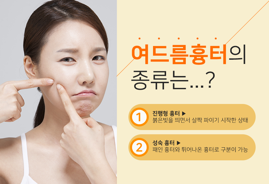 오목교역피부과 네오빔을 이용한 확실한 여드름 치료 관련 이미지 4