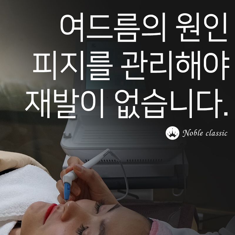 당산역여드름치료 원인을 제거하는 아그네스 관련 이미지 3