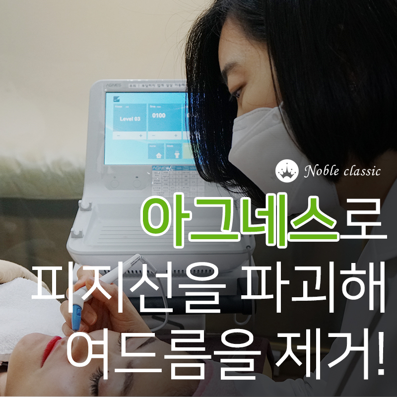 당산여드름 아그네스로 관리하자! 관련 이미지 4