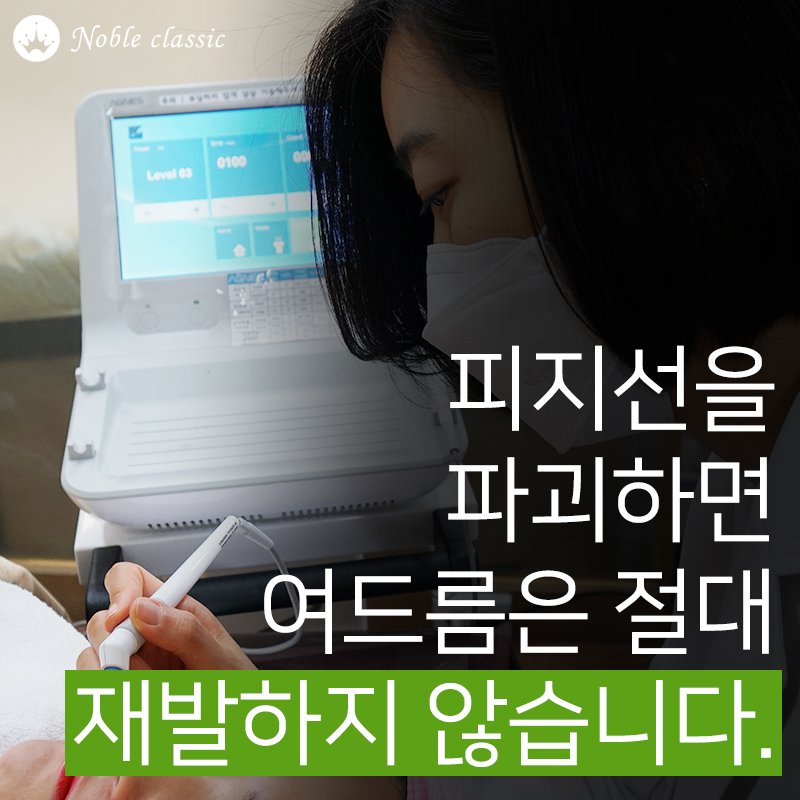 당산여드름 아그네스로 관리하자! 관련 이미지 7