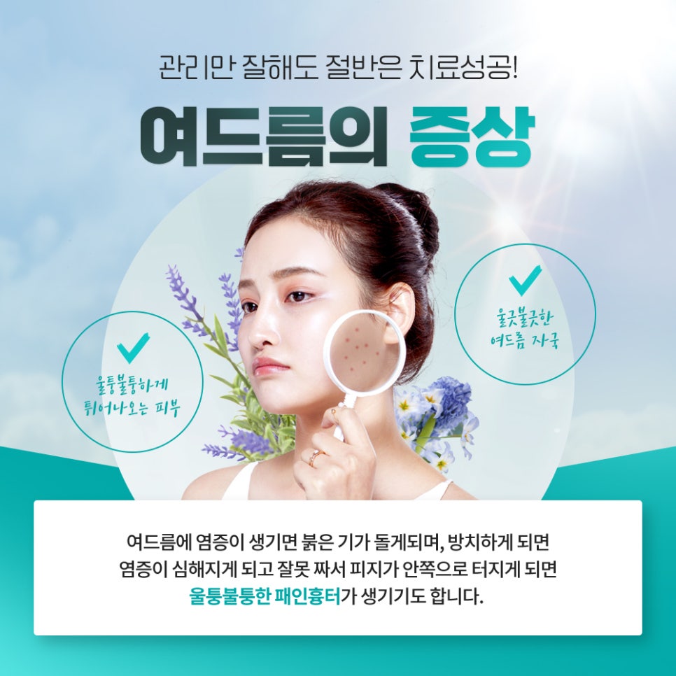 양평동피부과 압출 없는 여드름치료, 네오빔레이저! 관련 이미지 3