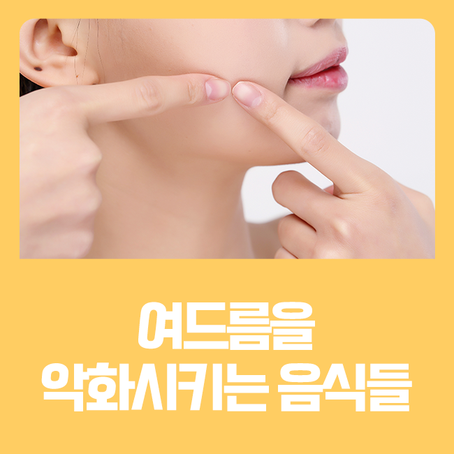 여드름에 좋지 않은 음식 알려드립니다 :) 관련 이미지 1