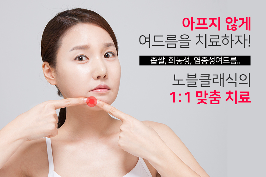 영등포구청피부과 작은 여드름도 놓치지 않고 관련 이미지 2