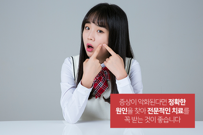 여름철, 여드름 관리법을 알려드립니다 관련 이미지 5