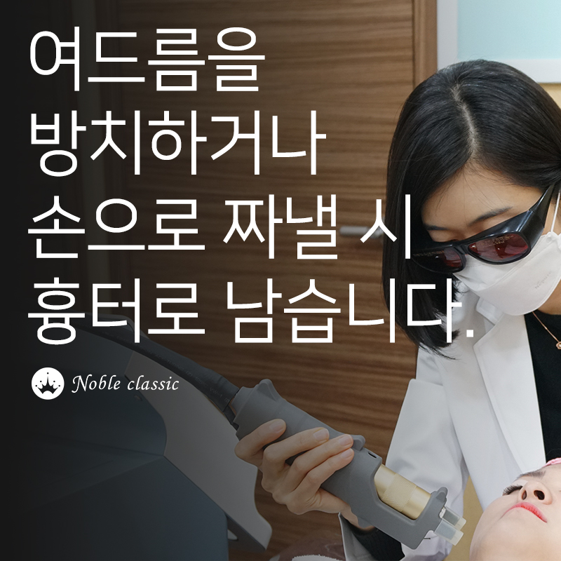 당산역여드름흉터치료 단계별로 개선하자! 관련 이미지 3