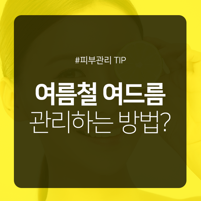 여름철, 여드름 관리법을 알려드립니다 관련 이미지 1