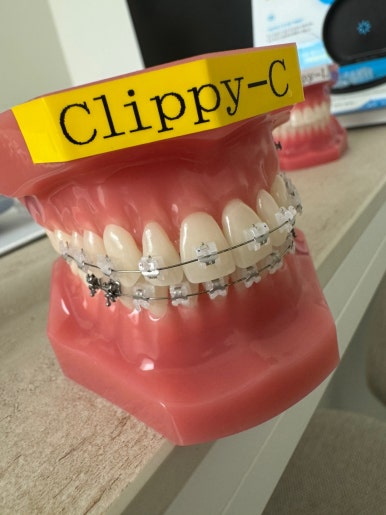 반포동치과 일요일도 교정과 전문의와 함께하는 인비절라인 교정치과. 관련 이미지 9