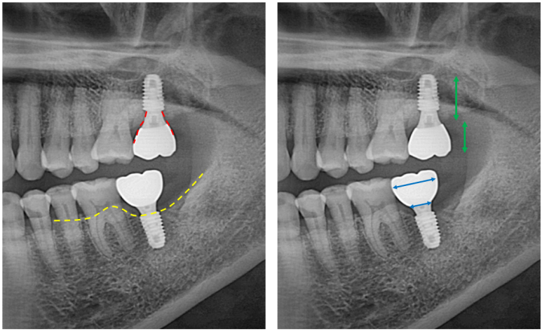 치과 전문의가 하는 일 - 치주과, 치과보존과, 치과보철과, 치과교정과 전문의가 있는 치과. 관련 이미지 15
