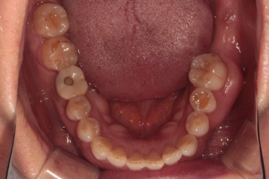 치과 전문의가 하는 일 - 치주과, 치과보존과, 치과보철과, 치과교정과 전문의가 있는 치과. 관련 이미지 10